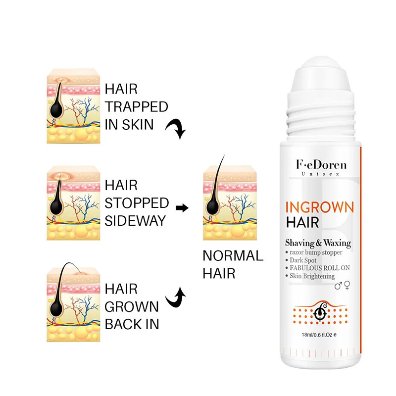 

Ingrown Hairs treatment After Shave Repair dark spot Serum for vanishRazor Burns