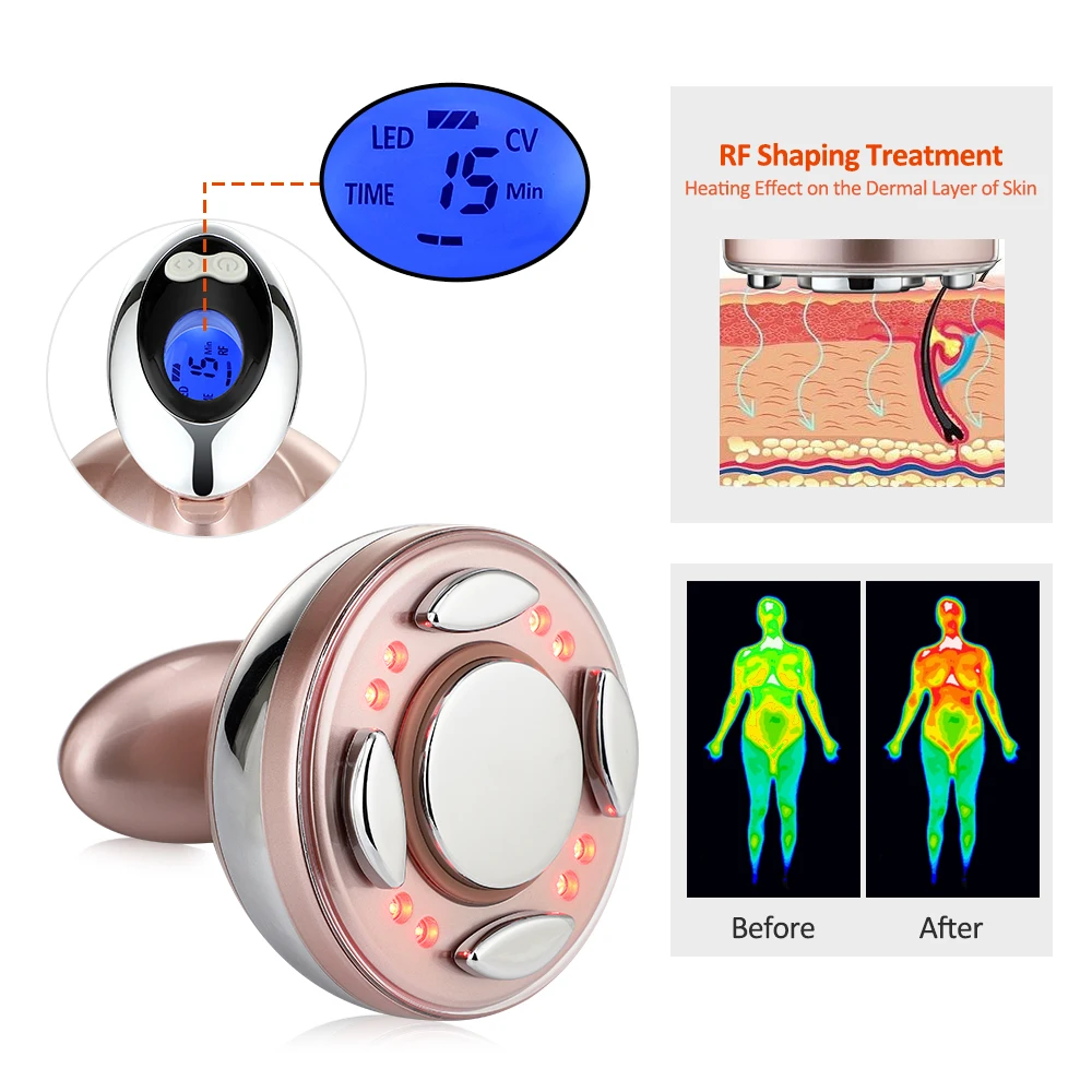 Koop Rf Cavitatie Ultrasone Afslanken Massager Led Fat Burner Anti Cellulitis Lipo Apparaat Huidverstrakking Gewichtsverlies Schoonheid Machine