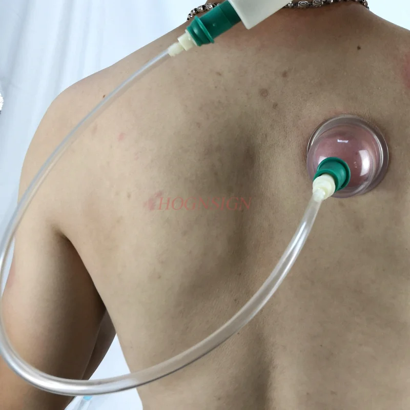 7 шт./компл. вакуумный всасывающий пистолет для Вентоса Terapia универсальный