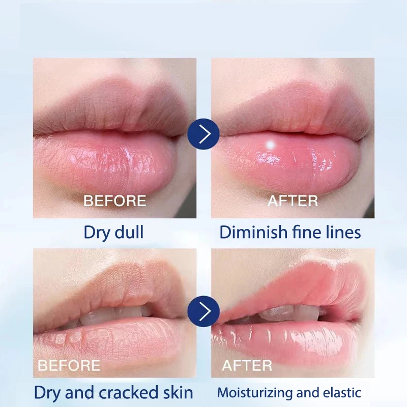 2022 Vaseline Lip Balm Can Moisturize Lips Prevent Cracking and Repair Lines with Long-lasting Moisture lip care 1 Bottle |