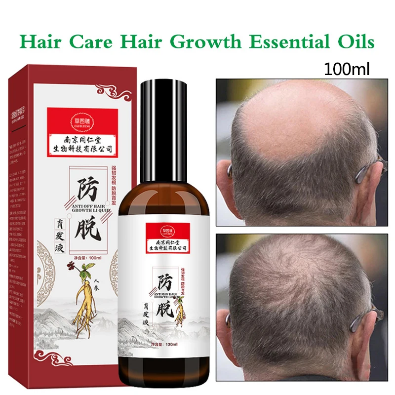 

Fast Hair Growth Spray Treatment Serum 100ML Anti-Hair Loss Liquid Prevent Baldness Nourish Dense Hair Roots Regrowth