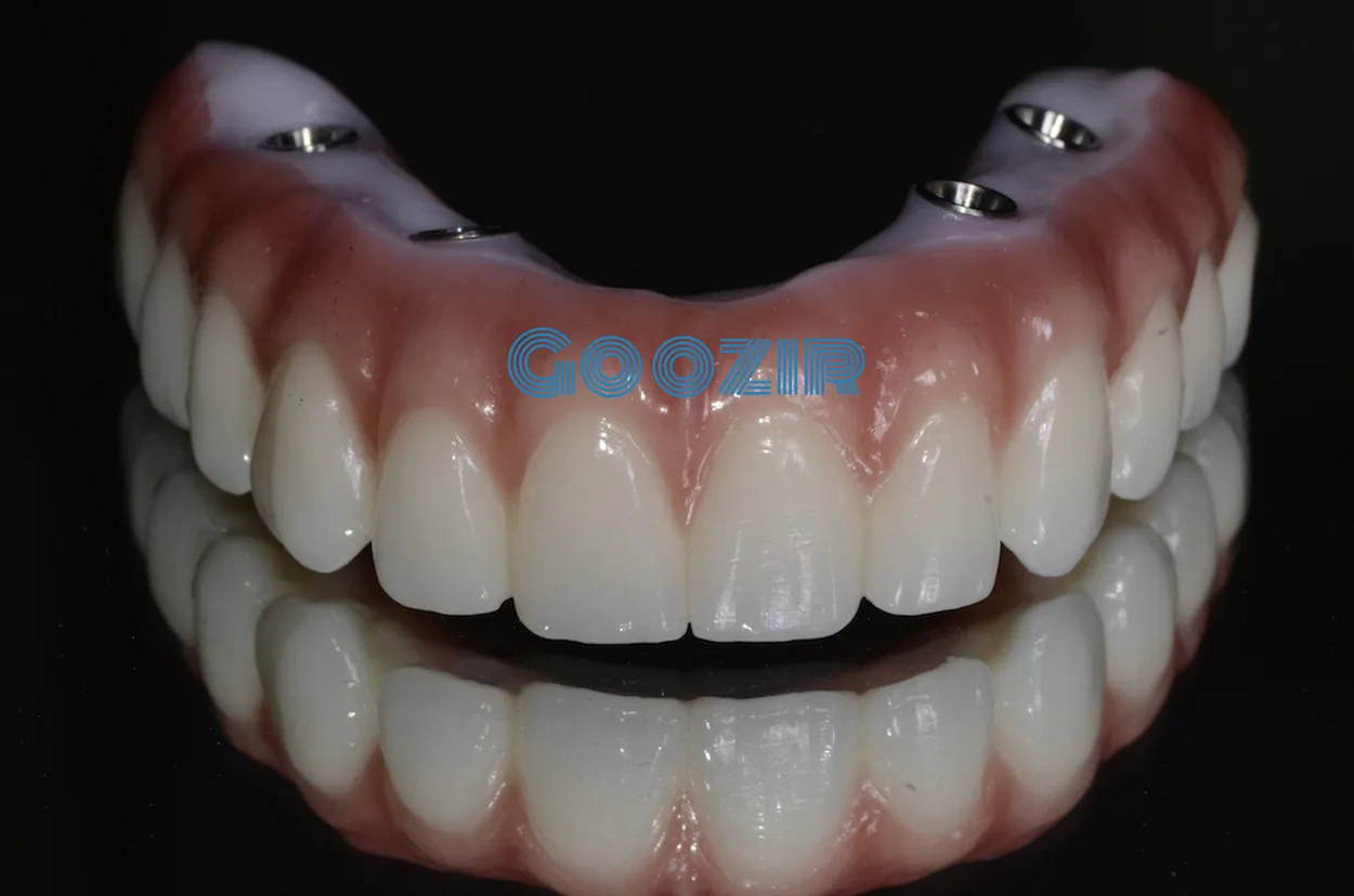 Goozir Super Translucent  Blank CAD CAM Ceramic Zirconia Block Dental Materials For Other Dental Equipments Zirconia Disc images - 6