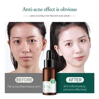 laikou tea tree acne treatment face serum whitening moisturizing oil control anti aging essence anti acne anti scar skin care