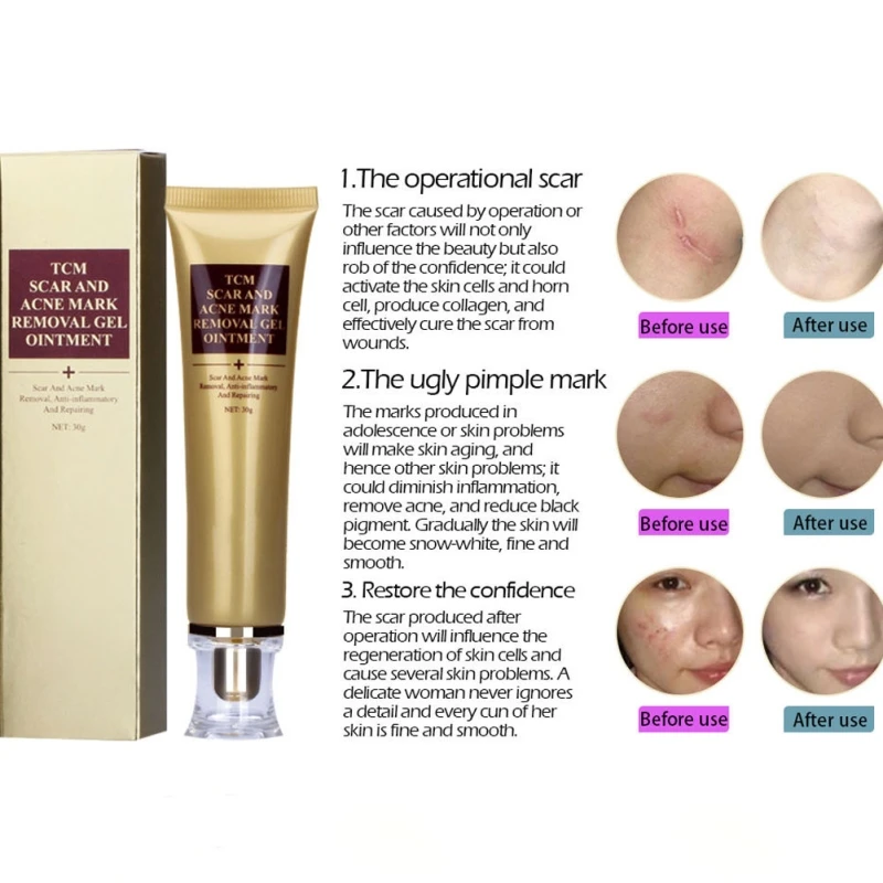 Крем для удаления угрей и шрамов отбеливающий экстракт женьшеня гель ухода за