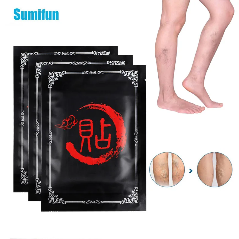 

8Pcs Varicose Vein Treatment Patch Phlebitis Vasculitis Thigh Spider Removal Anti Swelling Pain Relief Chinese Herbal Plaster