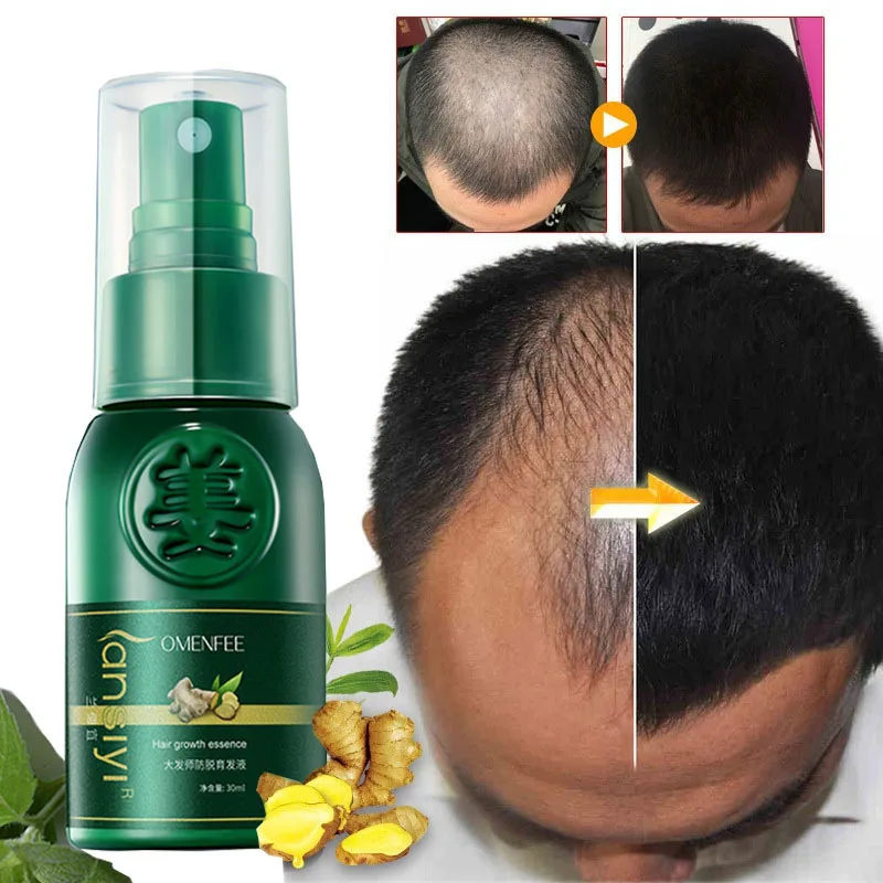 

Efficient Ginger Hair Growth Spray Serum Anti Hair Loss Treatment Products Prevent Hair Dry Frizzy Damaged Thinning Repair Care