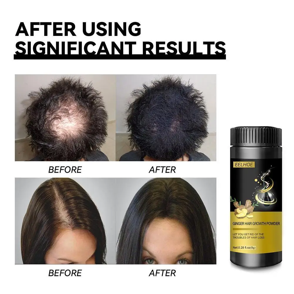 

Hair Regrowth Treatments Ginger Essence Powders For Hair Growth Herbal Thickening Hair Care Anti Hair Loss Hair Growth Products