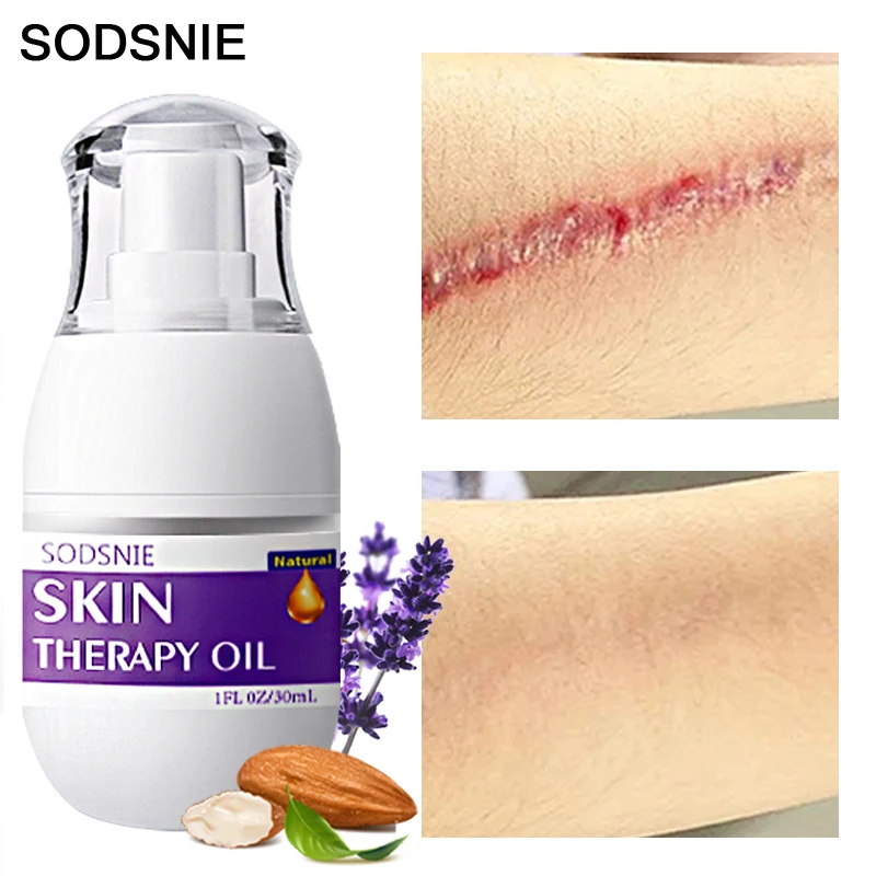 Уход за телом лечебное масло для ухода кожей удаление растяжек сглаживание