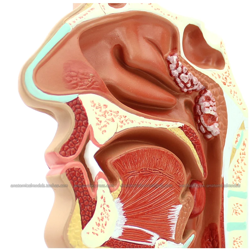 CMAM/12508 Pathological nasal cavity Human Respiratory System Medical Teaching Anatomical Model |