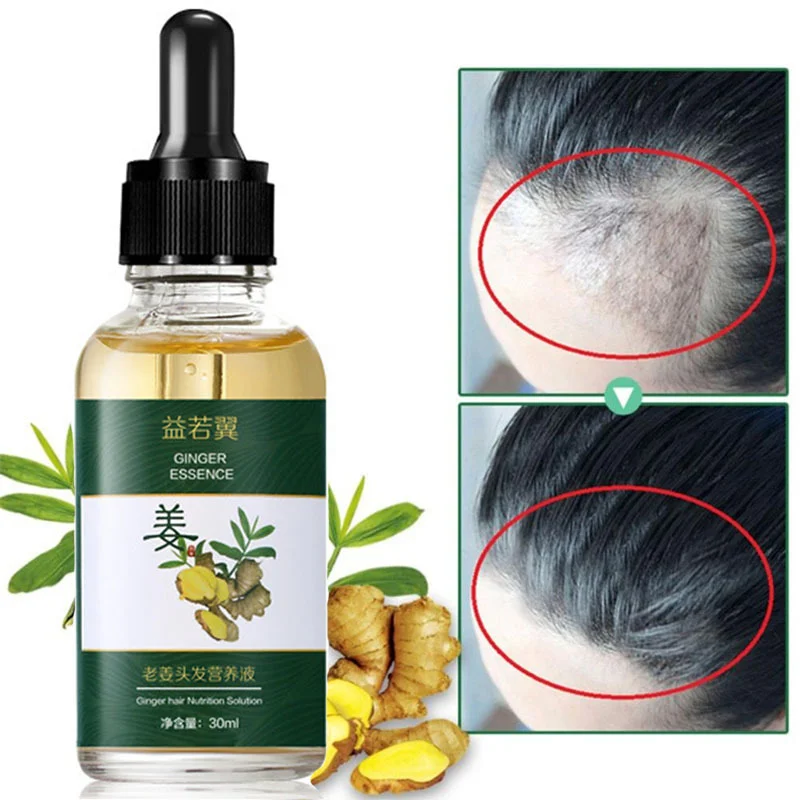 Уход за волосами мощный рост волос экстракт имбиря эфирное масло лечение