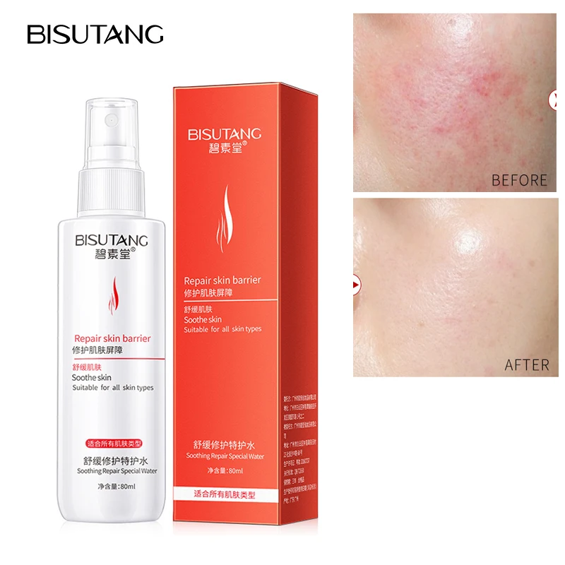 

Moisturizing Spray Toner Hydrating After Sun Care Aloe Centella Acne Treatment Repairing Redness Dullness Tonic Skin Care 80ML P