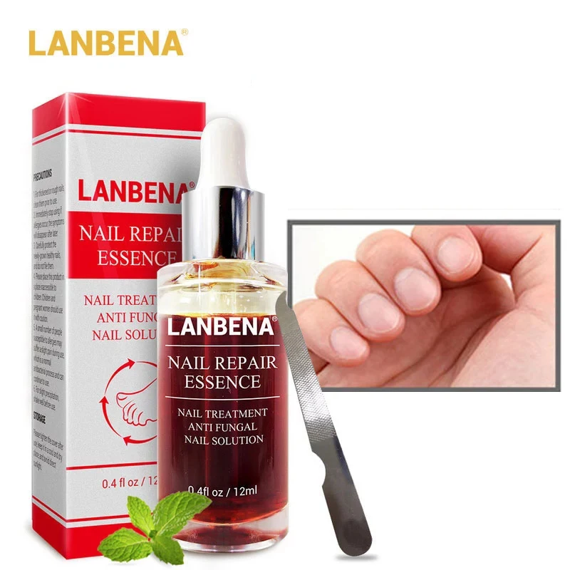 

Эссенция LANBENA для восстановления ногтей, сыворотка для удаления грибка, гель для ногтей против инфекции, паронихия онихомикоз, Уход за ногтя...