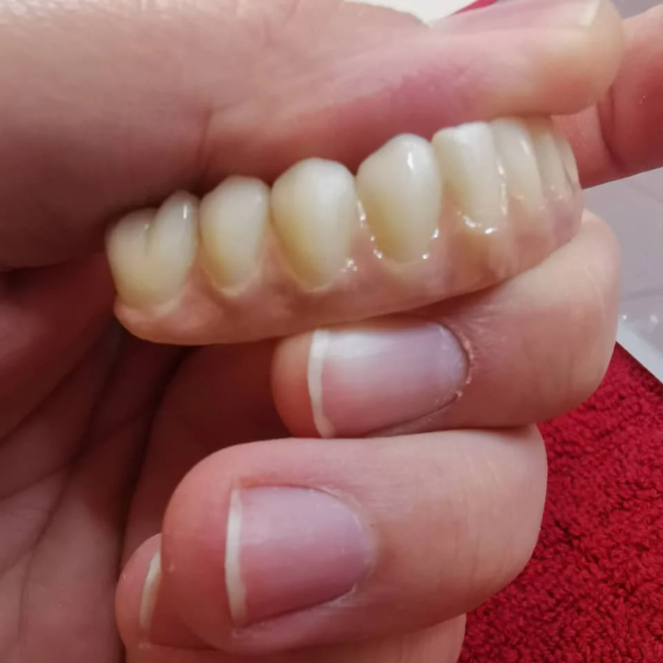

Dental Material ST Multilayer Zirconia Disc Suitable For Open CADCAM System for Making Full Brigde