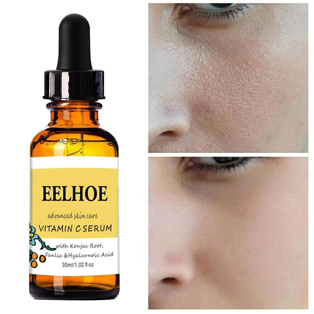 

Whitening Repair EssenceFreckle EssenceWhitening Moisturizing Essence