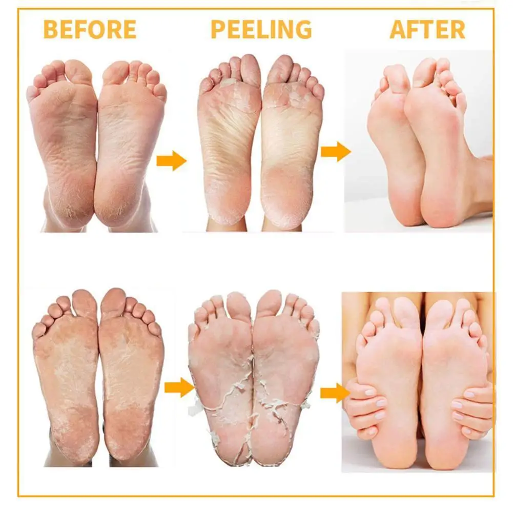 

1pair Aloe Exfoliating Foot Mask For Anti Crack Heel Care Pedicure tool Skin Callus Remover Socks Peeling Feet Smooth Dead X2W0
