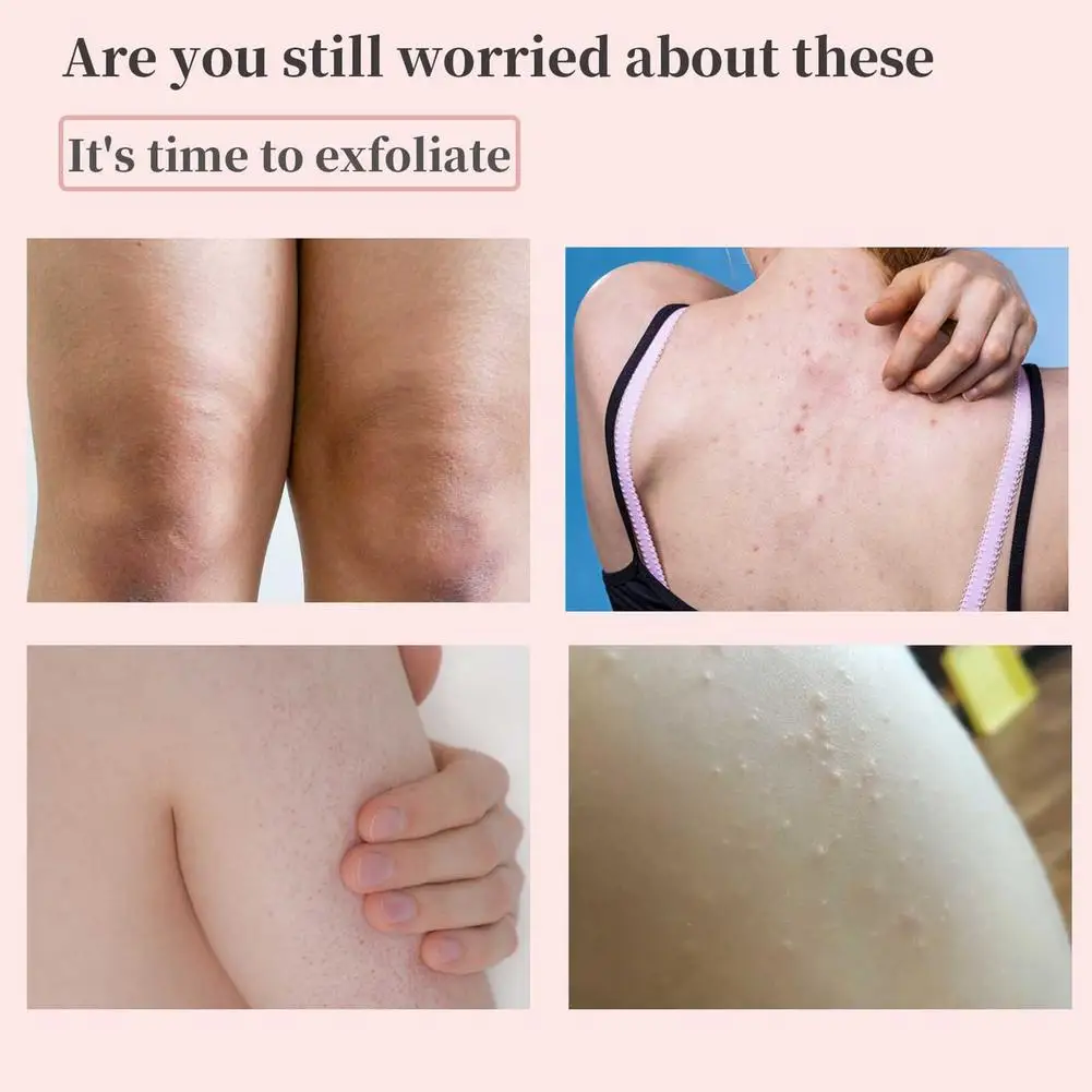 Отшелушивающий отбеливающий скраб для грязи большой емкости широко