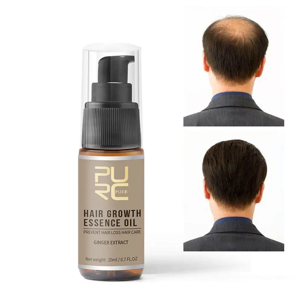 Уход за кожей головы и имбиря 20 мл | Красота здоровье