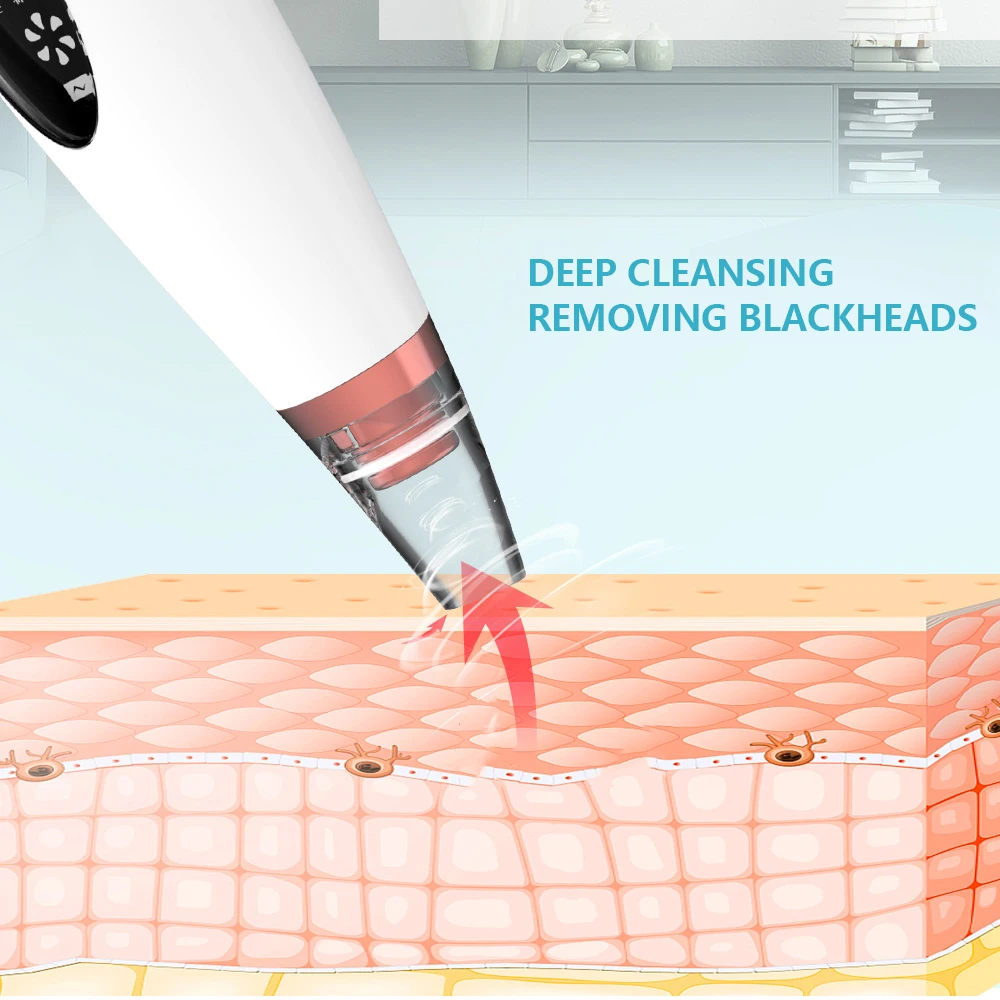 Устройство для удаления угрей вакуумный прибор и пор ухода за кожей USB|Устройство