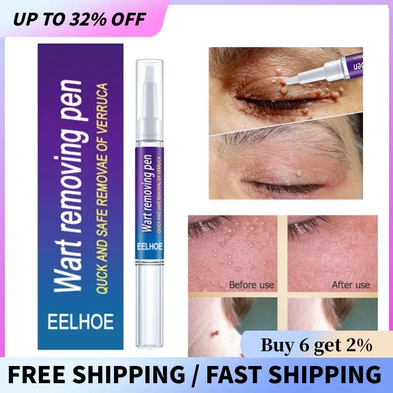 Крем для удаления папилломы родинок безболезненных пятен на лице веснушек