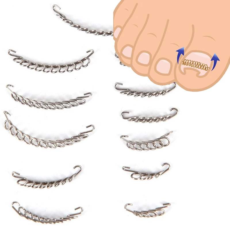 

Hot Sale 12pcs/box Nail Art Ingrown Toenails Correction Wire Recover Care Paronychia File Patch Corrector Foot Pedicure Tool