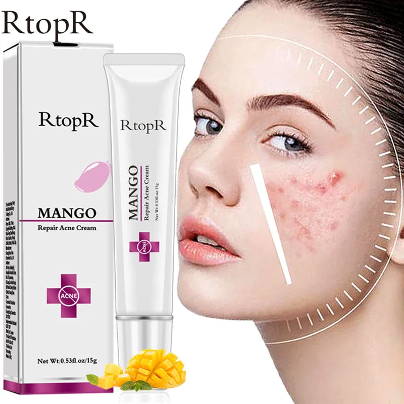 

RtopR Acne Treatment Face Cream Moisturizer Against Face Acne Scar Removal Cream Anti Acne Oil Deep Cleansing For Face Care 15g