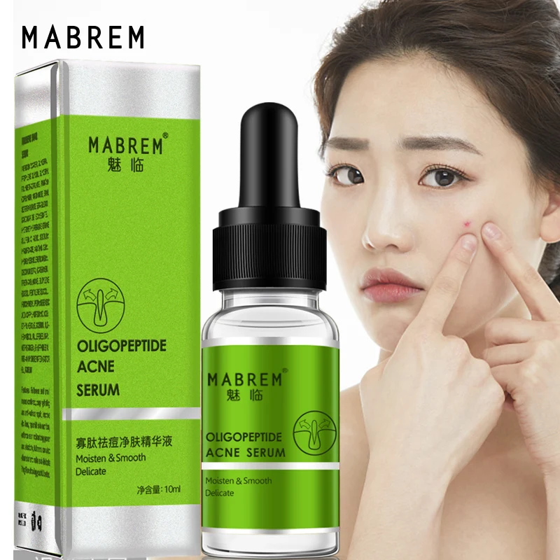 

Лосьон для удаления акне, с олигопептидом, 10 мл