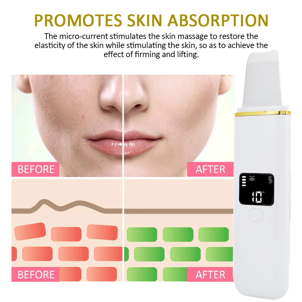 Ультразвуковой светодиодный скруббер для кожи Электрический пилинг Лопата