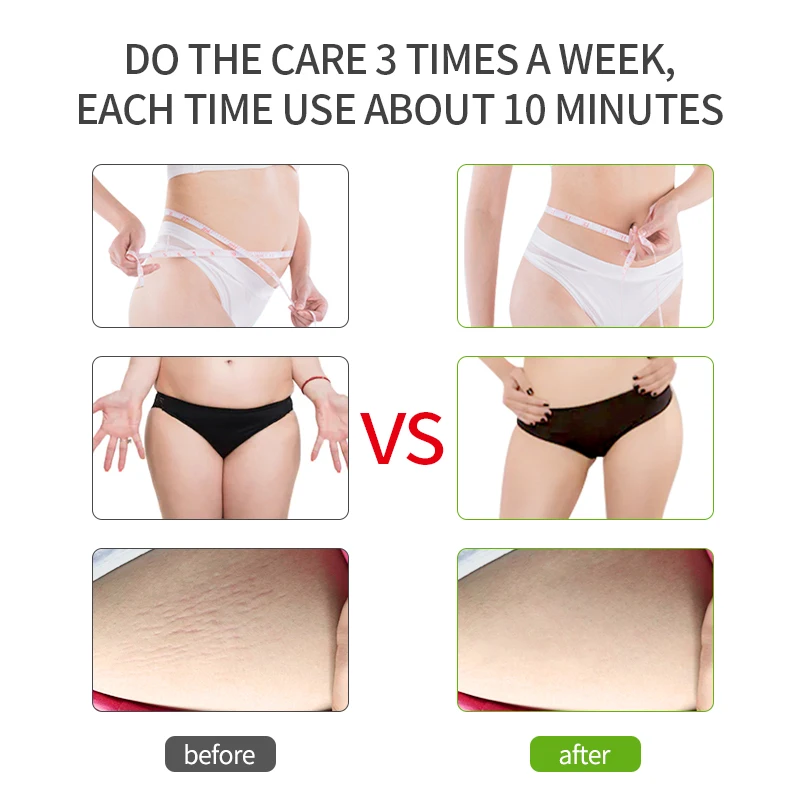 

Home Use Devices Fat Bursting Ultrasonic Radio Frequency Beauty Massager Fat Exploding Instrument Slimming Machine Dropshipping