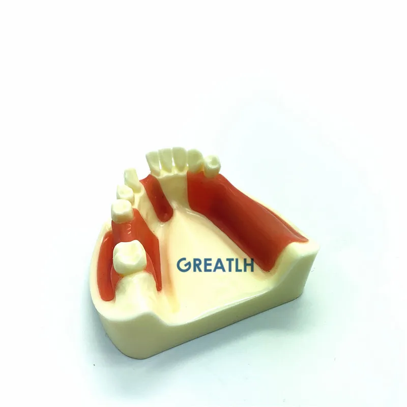 Стоматологическая нижняя челюсть Gingiva модель отсутствующие зубы