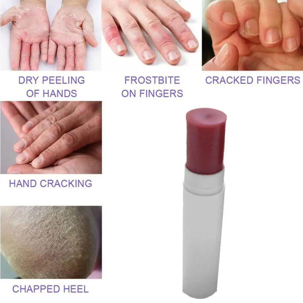 Женский Профессиональный питательный отбеливающий крем для удаления пятен на