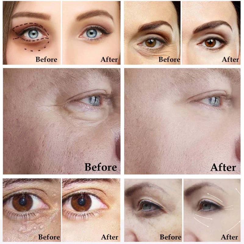 Крем для глаз с улиточной слизью пептид Коллаген Сыворотка Улитка эссенция