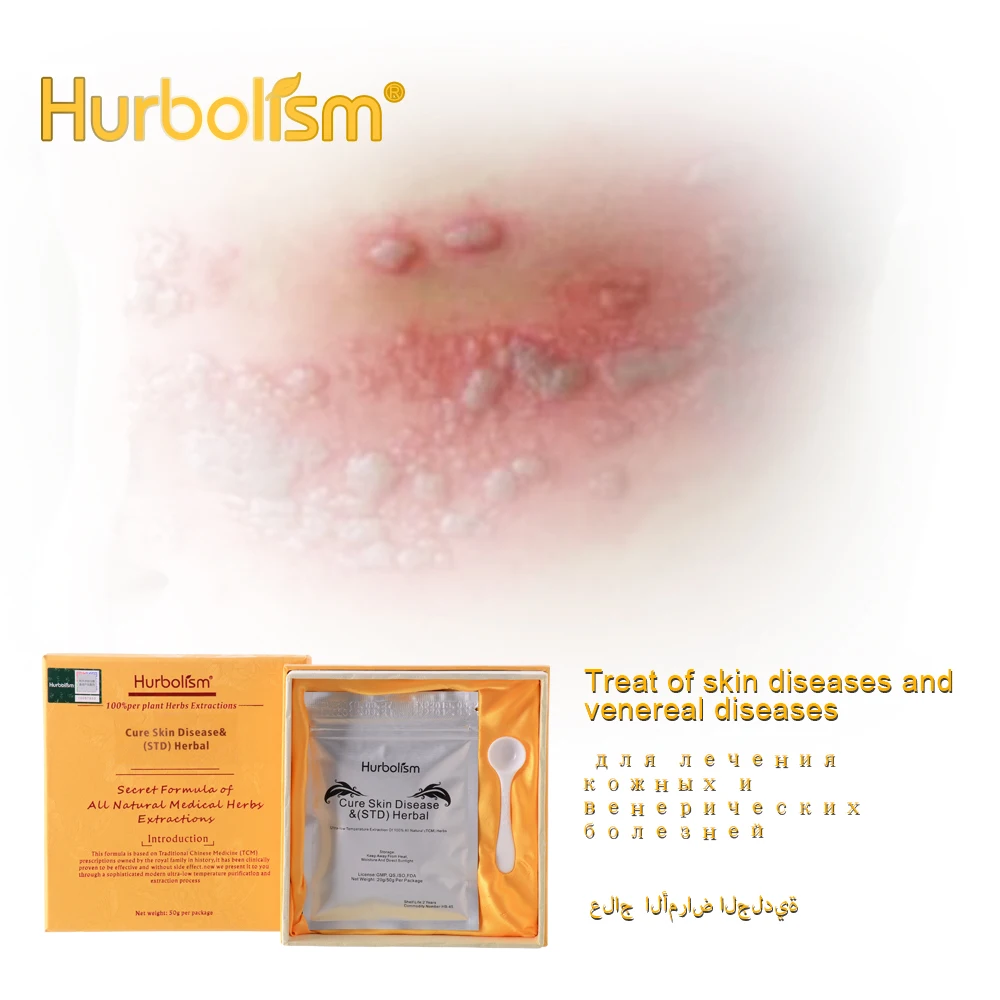 Hurbolism новое обновление TCM травяной порошок для лечения ЗППП и уничтожения