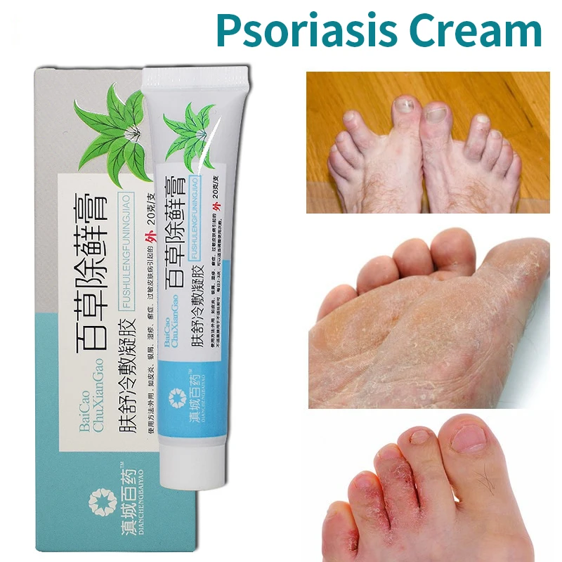 

Natural Psoriasis Cream Anti-Itch Herbal Snake Oil Medical Plaster Dermatitis Pruritus Eczema 100% Chinese Traditional Ointment