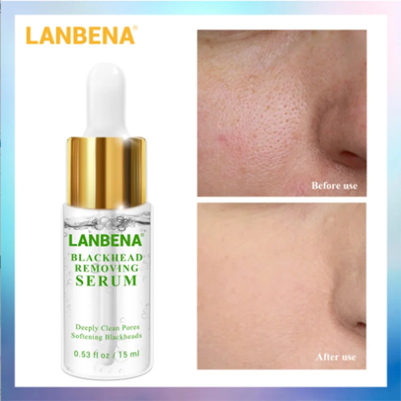 LANBENA, сыворотка для удаления черных точек, глубоко очищает поры, смягчает черные головки, деликатное удаление угревой сыпи, лечение прыщей, уход за кожей 15 мл