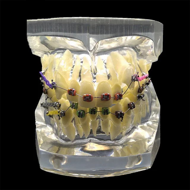 Malocclusion Model Стоматологическая стандартная Ортодонтическая модель прозрачная коррекция зубов дисплей модели с кронштейном лигатурная проволока Стоматологическая модель зубов - Цвет: Malocclusion Model