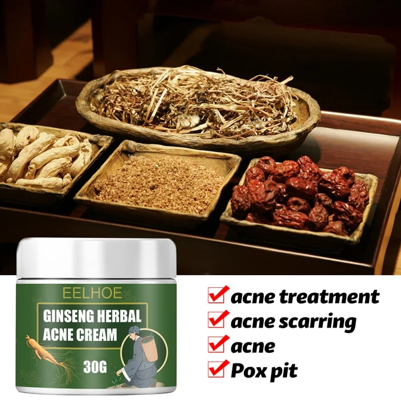 Herbal Ginseng Acne Cream Relieve Moisturizing Skin Care Blackhead Removal Facial | Красота и здоровье