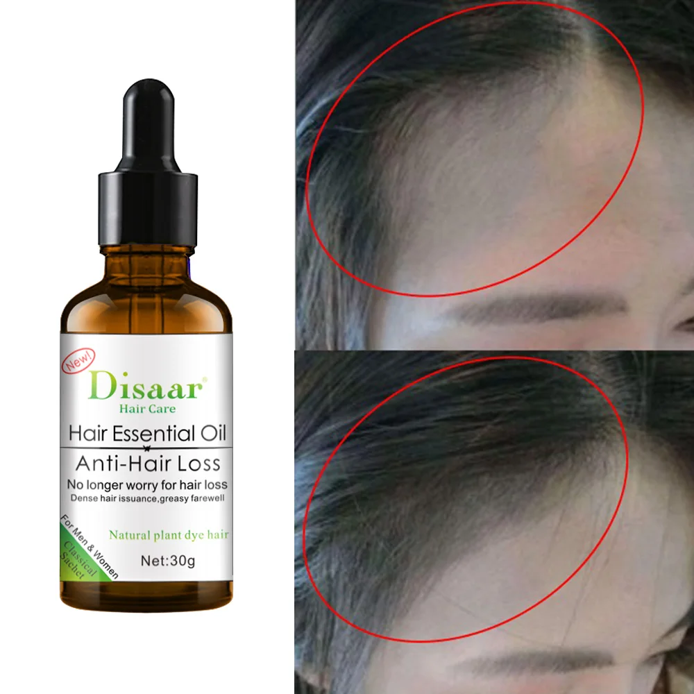 Hair Growth Products Fast Grow Hair Essential Oil Prevent Hair Loss Beauty Hair Care Scalp Frizzy Damaged Repair for Men Women