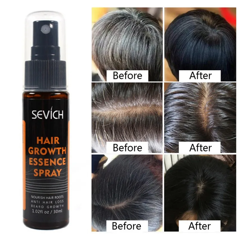 

Wholesale Hair Growth Essential Oil Liquid Spray Nourish Thick Glossy Roots Prevent Hair Loss Anti-hair For Men and Women