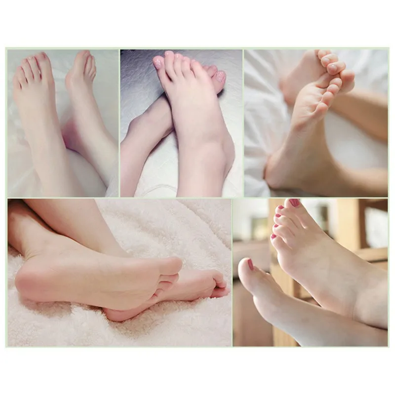 Отбеливающий Восстанавливающий омоложения кожи ног крем Отшелушивающий