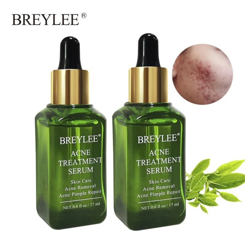 1 шт. 17 мл зеленая чайная субстанция от угревой сыпи сыворотка для лечения лица