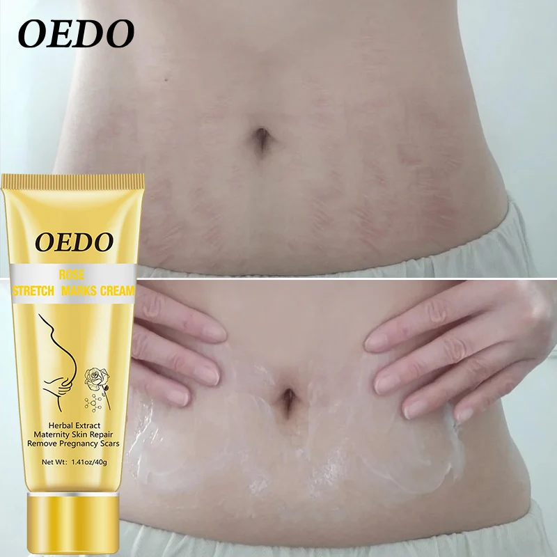

Rose Removes Stretch Mark Cream To Remove Postpartum Obesity Pregnant Women Repair Anti-Aging Anti-Winkles Firming Body Cream