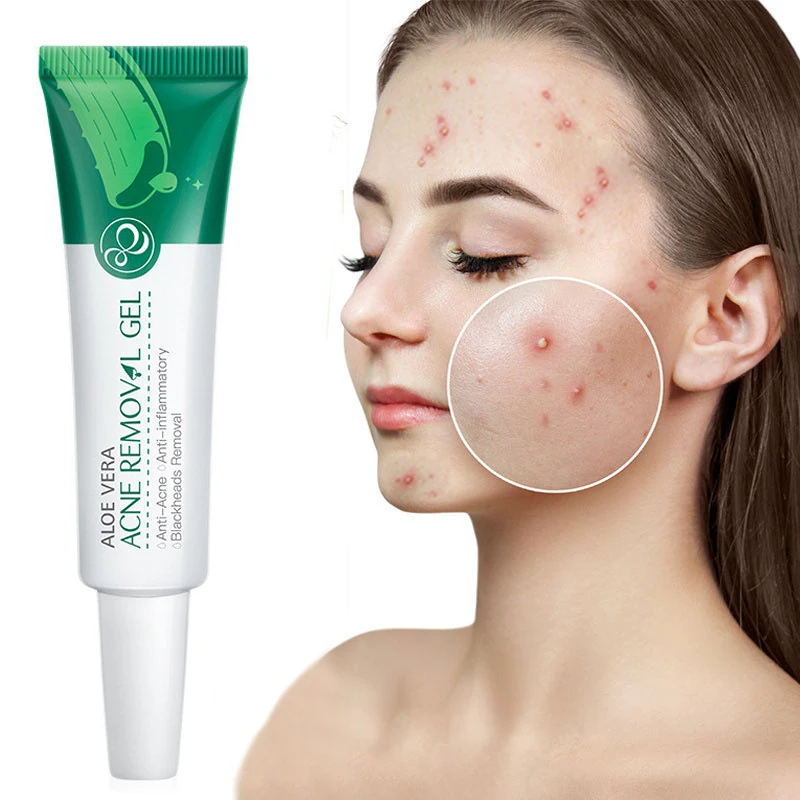 

Aloe Acne Treatment Gel Face Cream Serum Anti Acne Scar Cream Shrink Pores Moisturizing Oil Control Soothing Essence Skin Care