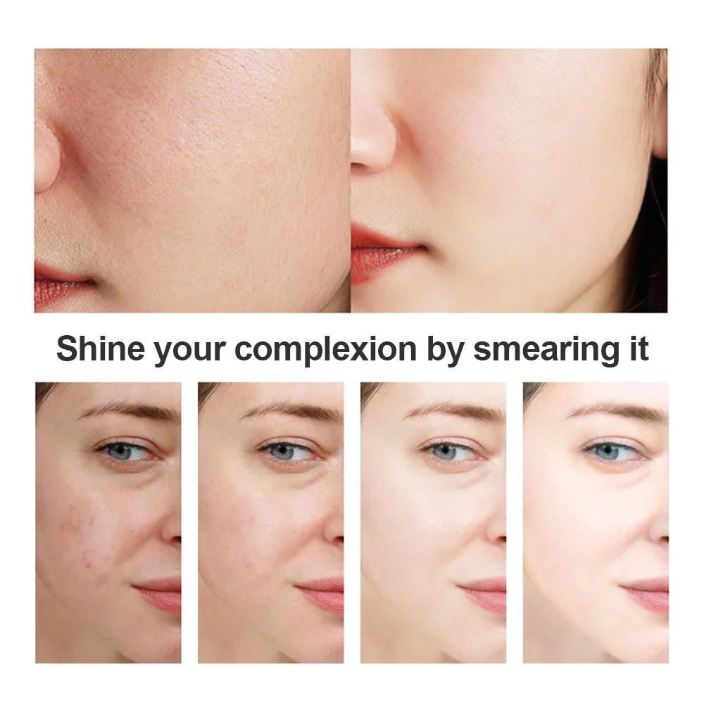 Отбеливающий увлажняющий крем для лица от морщин и прыщей | Красота здоровье