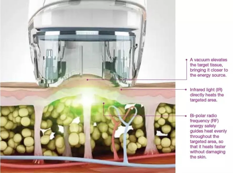 

Pay extra on your order