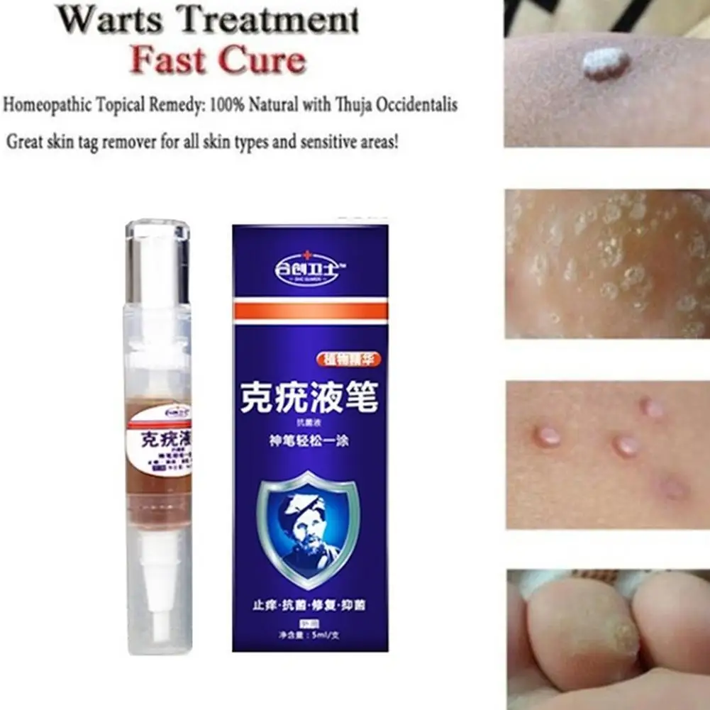 

1pcs Skin Tag Remover Against Mole Genital Wart Fast Corn within Removal Supplies Warts Removal Mole Removal Foot Papilloma D5X0