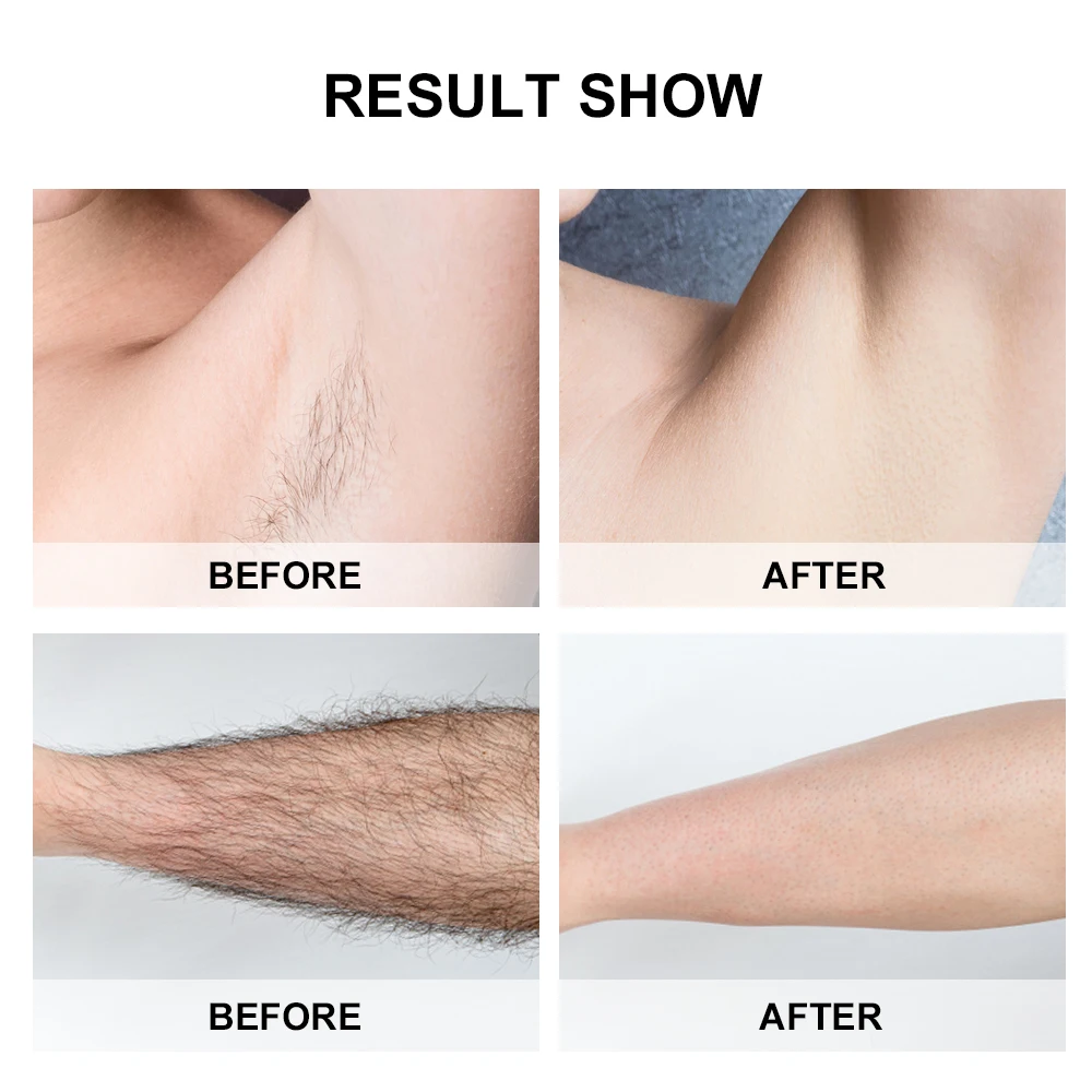 

Painless Laser Photon Freezing Point Epilator 990000 Flash Permanent Hair Remover Body Facial Hair Removal Machine Depilator