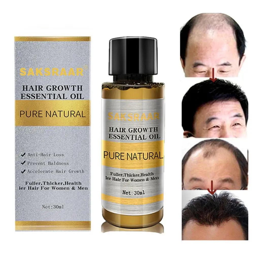 Уход за волосами для роста волос имбиря Эфирное Масла эссенция выпадения