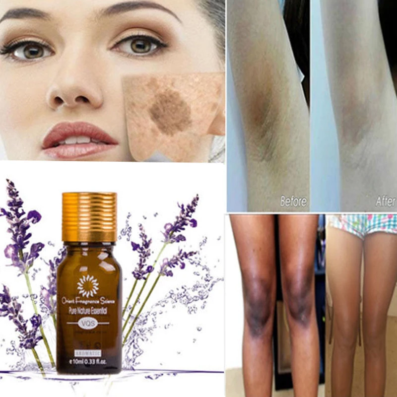 Отбеливающий Осветляющий завод эфирное масло белый мультипечь для