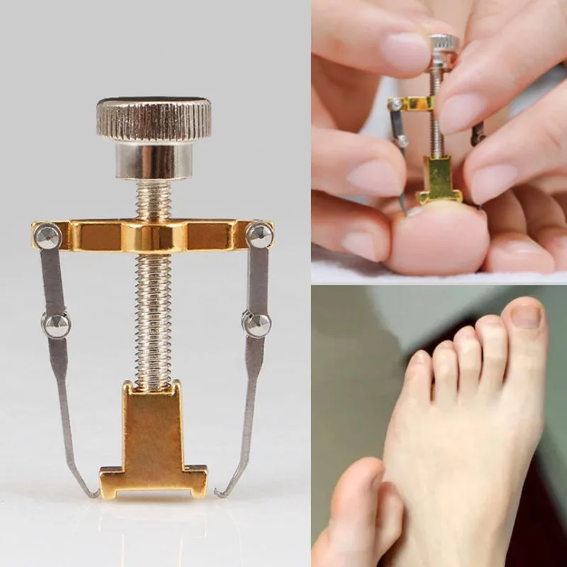 

Ingrown Toenails Correction Device Pedicure Foot Fixer Recover File Elastic Straightening Clip Brace Corrector Toe Nail Care