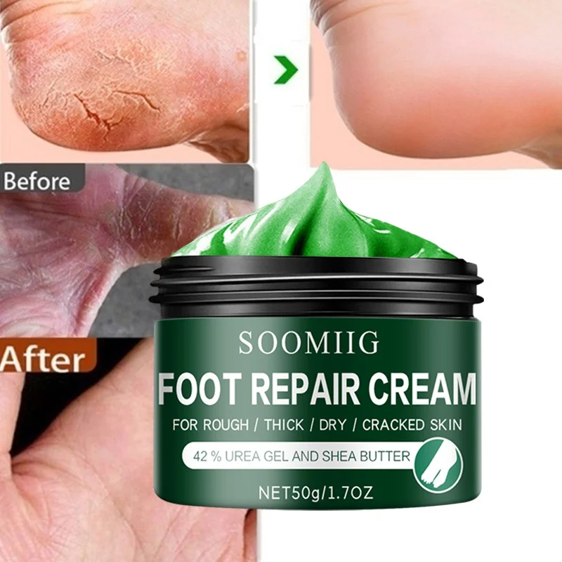 

Chapped heels heel crack anti-cracking and peeling repair cream foot care cream